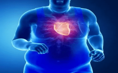 hombre corazon corriendo sindrome de pickwick